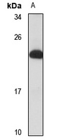 RNF152 Rabbit Polyclonal Antibody