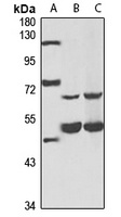 RNPC3 Rabbit Polyclonal Antibody