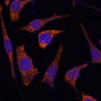 Anti-RPE Antibody