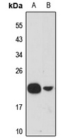 Ribosomal Protein L21 Rabbit Polyclonal Antibody