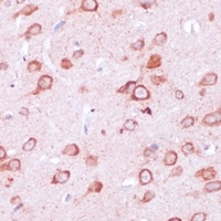 Ribosomal Protein L21 Rabbit Polyclonal Antibody