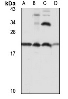 Ribosomal Protein L26 Rabbit Polyclonal Antibody