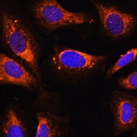 Ribosomal Protein L26 Rabbit Polyclonal Antibody