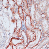 RPL31 antibody