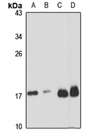 Ribosomal Protein L32 Rabbit Polyclonal Antibody