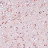 Ribosomal Protein L32 Rabbit Polyclonal Antibody