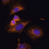 Ribosomal Protein L32 Rabbit Polyclonal Antibody