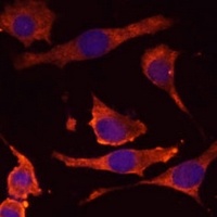 Anti-RPL36AL Antibody