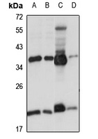 Ribosomal Protein L6 Rabbit Polyclonal Antibody