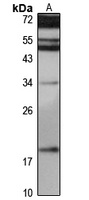 RPP21 Rabbit Polyclonal Antibody