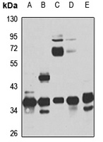 RPRD1B Antibody