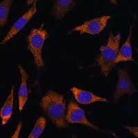 Anti-RPS25 Antibody