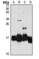 Ribosomal Protein S26 Rabbit Polyclonal Antibody