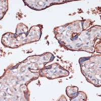 Anti-RSK3 Antibody