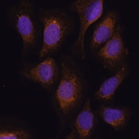 Anti-RSK3 Antibody