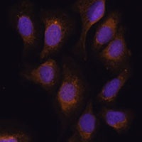 RSK3 antibody