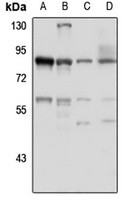 MSK2 Rabbit Polyclonal Antibody