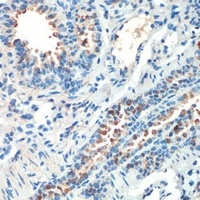 MSK2 antibody