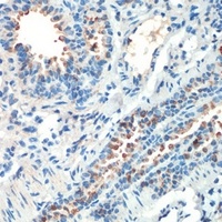 MSK2 Rabbit Polyclonal Antibody