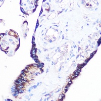 RRAGA Antibody