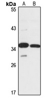 RRP36 Rabbit Polyclonal Antibody