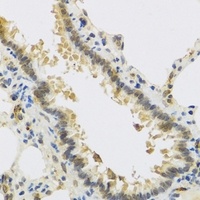 Anti-RSPO1 Antibody