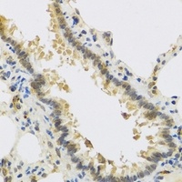 RSPO1 antibody