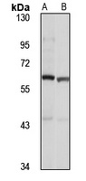 ETO Rabbit Polyclonal Antibody