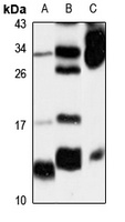 S100-A14 Antibody