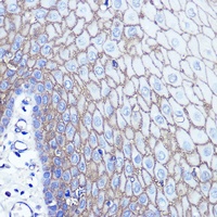 S100-A14 antibody