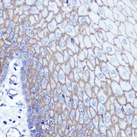 S100-A14 Antibody