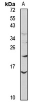 SAA Rabbit Polyclonal Antibody