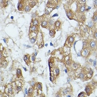 Anti-SAA4 Antibody