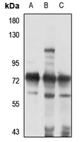 SALL4 Rabbit Polyclonal Antibody