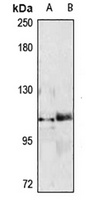 SALL4 Rabbit Polyclonal Antibody