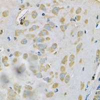 Anti-SAR1A Antibody