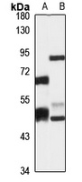 SerRSmt Rabbit Polyclonal Antibody