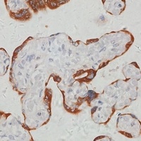 SerRSmt Rabbit Polyclonal Antibody