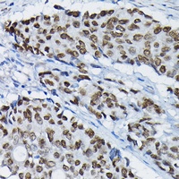 Anti-SATB2 Antibody