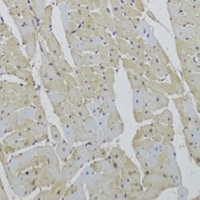 Anti-CD36 Antibody