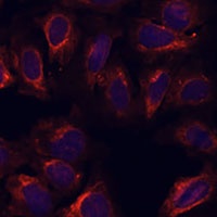 Anti-SCGB3A2 Antibody