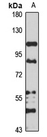 Adseverin Rabbit Polyclonal Antibody