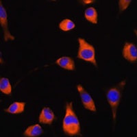 Adseverin Rabbit Polyclonal Antibody