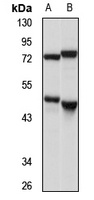 Selenocysteine Lyase Rabbit Polyclonal Antibody