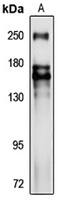 Nav1.2 Rabbit Polyclonal Antibody