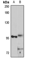 SCYL2 Rabbit Polyclonal Antibody