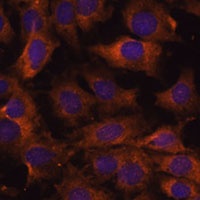 Anti-SEC23B Antibody