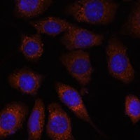 Anti-SEC24D Antibody