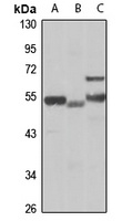 SLA/LP Antibody