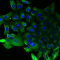 SLA/LP antibody